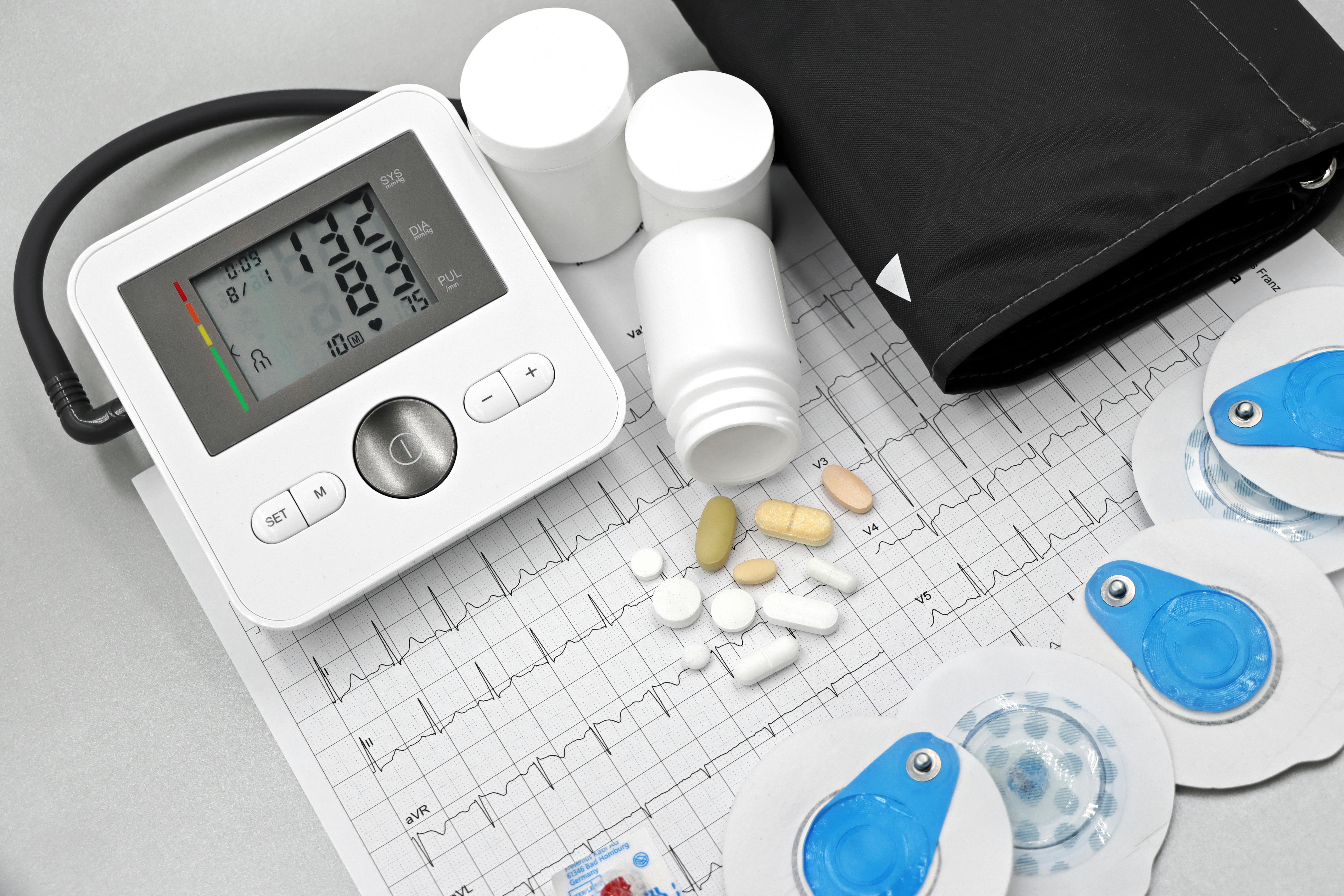 Heart Monitoring
